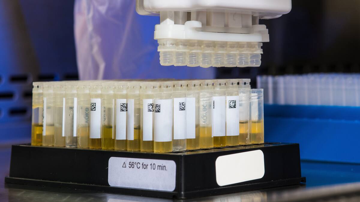 Orina. Foto: Unsplash.