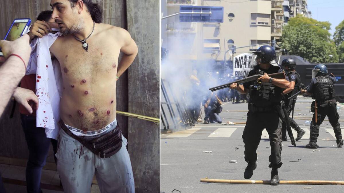 Pablo Piovano - Fotógrafo baleado en represión - Reforma previsional (NA)