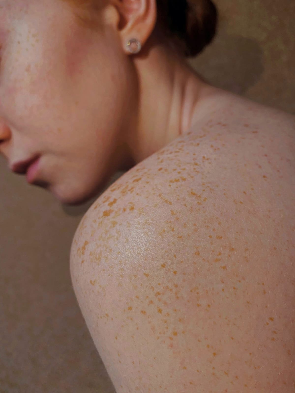 Piel. Foto Unsplash