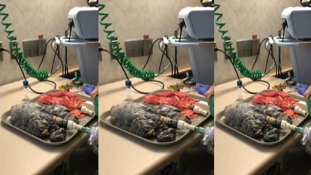 Pulmones - funcionamiento