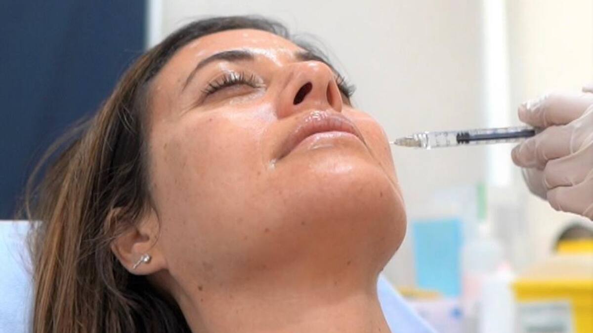 Relleno facial. Foto: EFE.