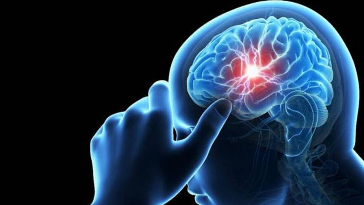 Cerebro.
