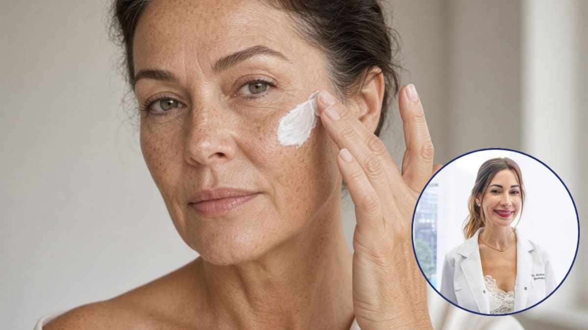 Andrea Rey, dermatóloga, sobre la aparición de manchas después de los 50: “La piel tiene una memoria biológica del daño solar”