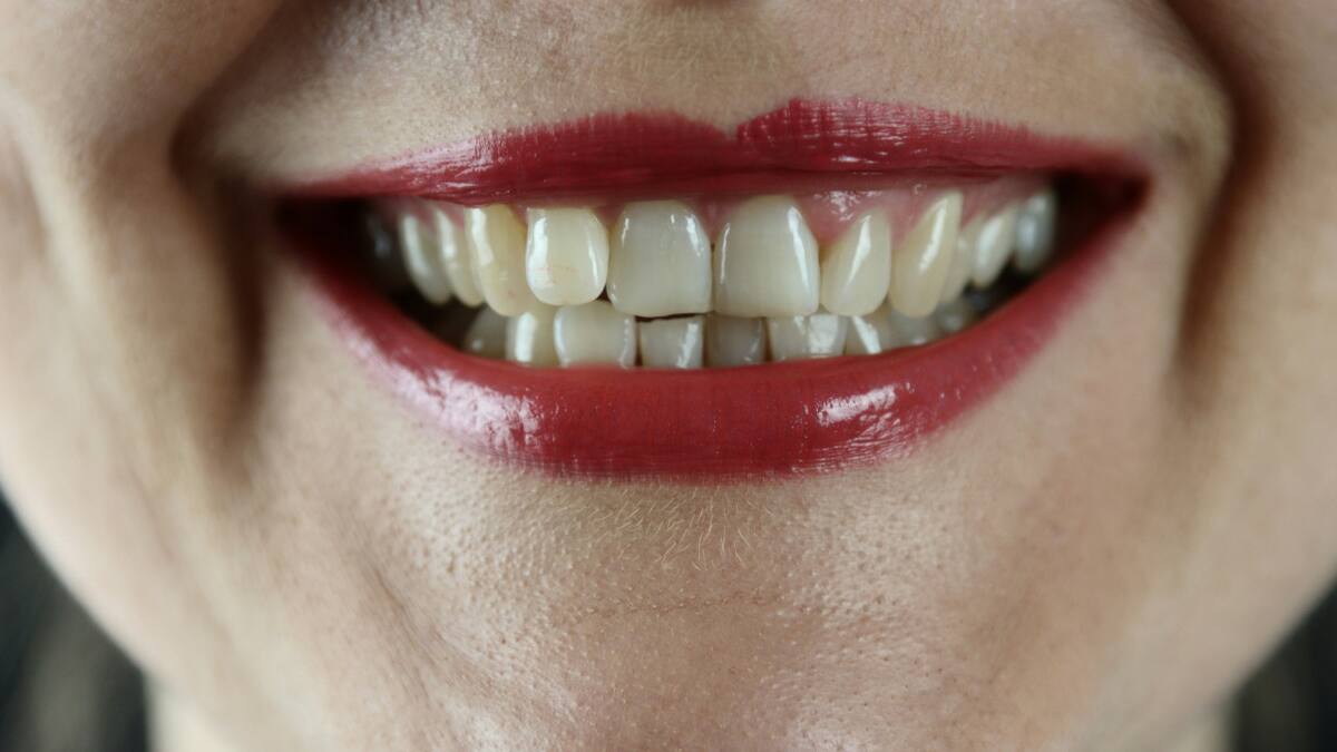 El aliado natural para una sonrisa más saludable y blanca. Foto: Unsplash.