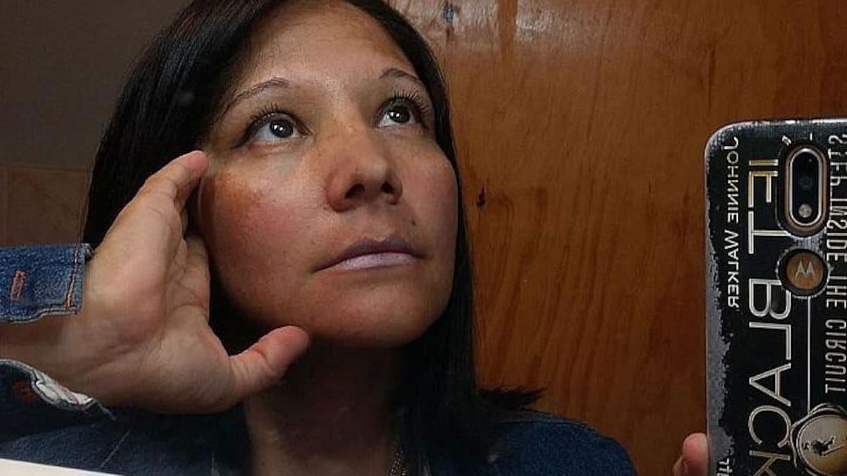 Tamara Gómez, mala praxis, liposucción