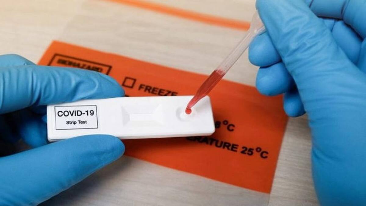 Test contra el coronavirus