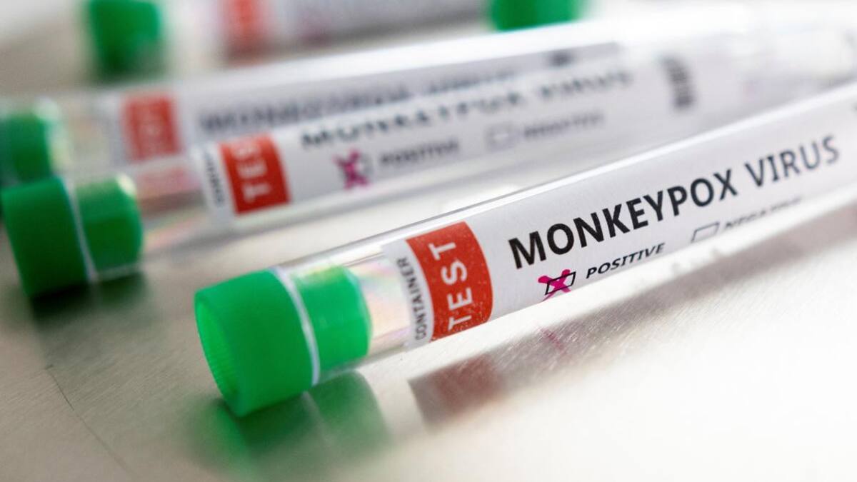 Test contra viruela del mono, Foto Reuters