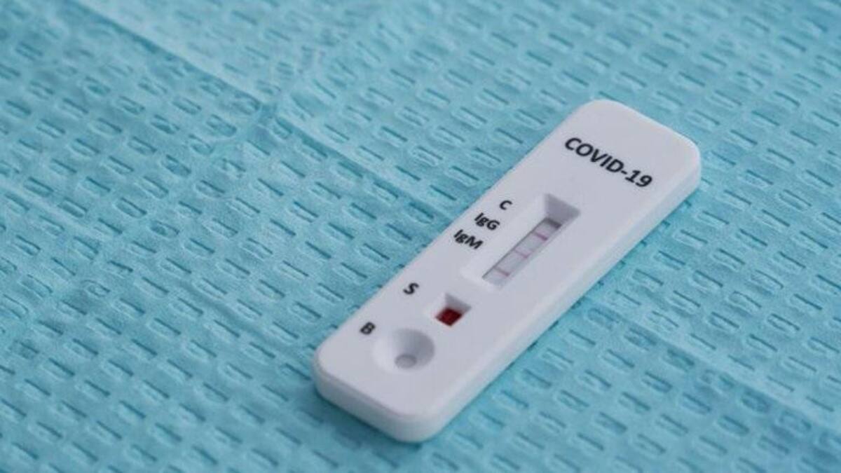 Test COVID-19 Islandia