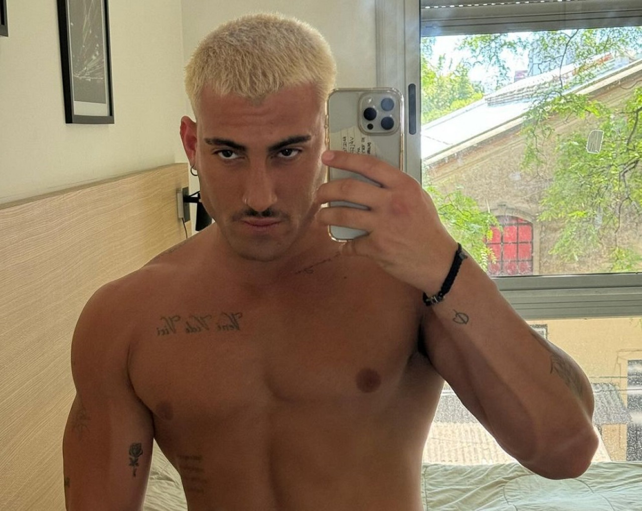 El sucesor: Tomás Holder se hizo una cirugía estética y en las redes sociales lo compararon con Ricardo Fort