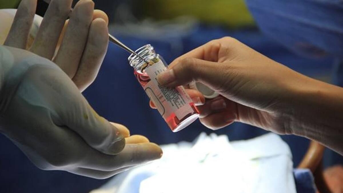 Brasil: al menos 6 personas dan positivo para VIH por trasplantes de órganos infectados