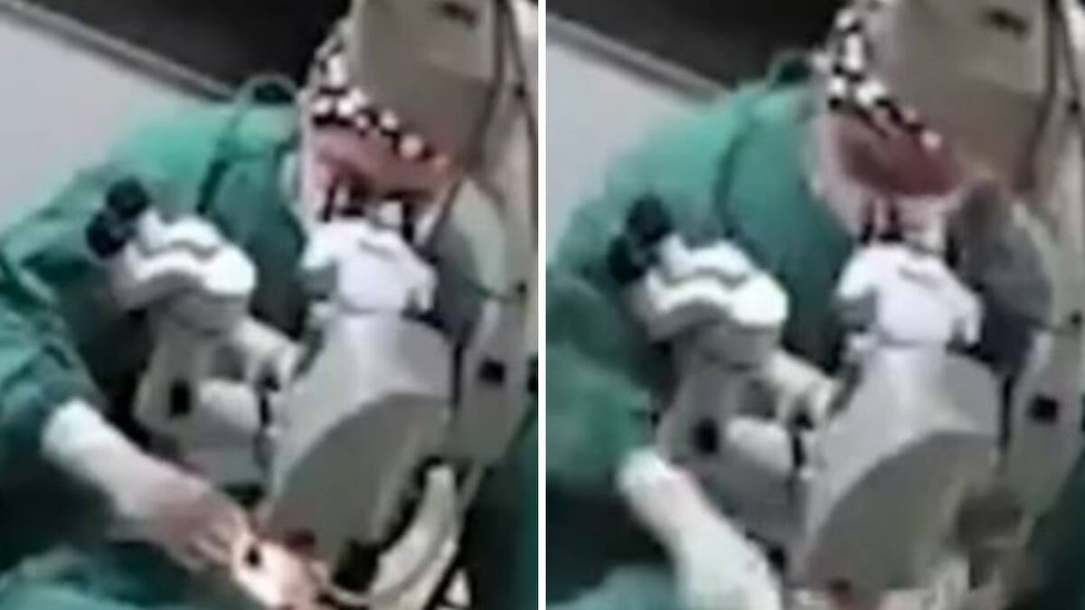 Un médico de China golpeó a una paciente durante una cirugía de ojos. Foto: captura de video.