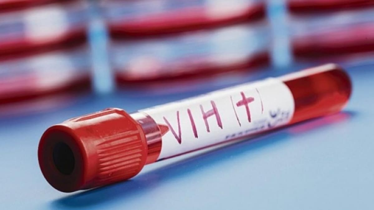 Fondo mundial advierte de "desafíos colosales" frente al sida, tuberculosis y malaria